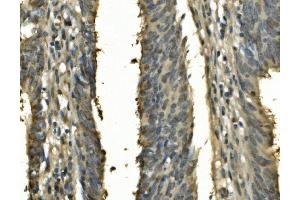 IHC analysis of PSME2 using anti-PSME2 antibody (ABIN7599137).