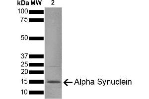 SDS-PAGE (SDS) image for Synuclein, alpha (SNCA) (full length) (Active) protein (ABIN5651245)