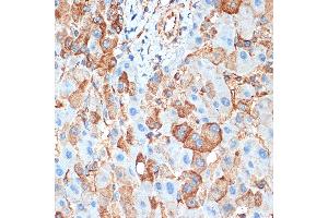 Immunohistochemistry of paraffin-embedded human liver using B Rabbit mAb (ABIN1678826, ABIN3015929, ABIN3015930 and ABIN7101463) at dilution of 1:100 (40x lens).