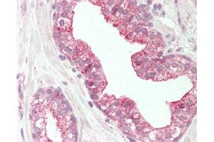 Human Prostate: Formalin-Fixed, Paraffin-Embedded (FFPE).