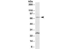 Western blot testing of human olfactory bulb lysate with SLC6A12 antibody at 1ug/ml. (SLC6A12 anticorps)