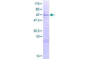 Image no. 1 for Citrate Lyase beta Like (CLYBL) (AA 1-340) protein (GST tag) (ABIN1349768)