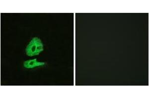 Immunofluorescence analysis of HeLa cells, using GLR Antibody. (GLRa2 anticorps  (AA 95-144))