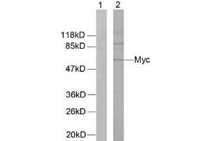 Western blot analysis of extracts from ovary cancer cells using Myc (Ab-58) antibody (E021034). (c-MYC anticorps)