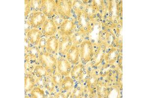 Immunohistochemistry of paraffin-embedded mouse kidney using PDE4DIP antibody at dilution of 1:100 (40x lens).
