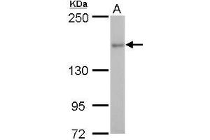 WB Image ROCK2 antibody detects ROCK2 protein by western blot analysis. (ROCK2 anticorps)