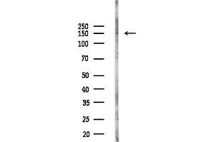 Western blot analysis of lysates from Hela cells(UV,30 min treatment), using MYBPC3 Antibody at 1/1000 dilution.