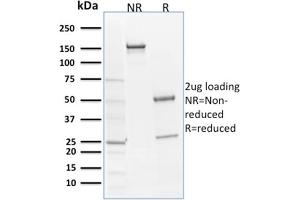 SDS-PAGE Analysis Purified SOX9 Mouse Monoclonal Antibody (SOX9/2398). (SOX9 anticorps  (AA 393-508))
