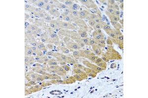 Immunohistochemistry of paraffin-embedded human liver using ARSF antibody at dilution of 1:100 (40x lens). (ARSF anticorps)