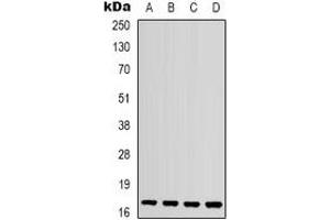 Western blot analysis of IL-1F10 expression in mouse kidney (A), mouse heart (B), mouse brain (C), rat spleen (D) whole cell lysates.