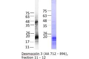 Desmocollin 3 Protein (DSC3) (AA 712-896) (His tag)
