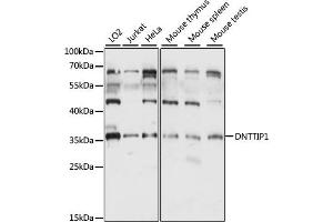 Western blot analysis of extracts of various cell lines, using DNTTIP1 antibody (ABIN7266731) at 1:1000 dilution. (DNTTIP1 anticorps  (AA 1-329))