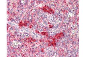 Anti-TSHZ2 antibody IHC staining of human spleen.