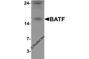 Western Blotting (WB) image for anti-Basic Leucine Zipper ATF-like Transcription Factor (BATF) (N-Term) antibody (ABIN1077388) (BATF anticorps  (N-Term))