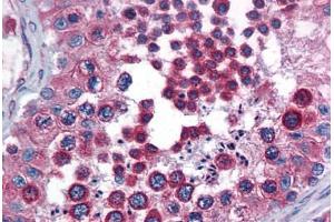 Human Testis: Formalin-Fixed, Paraffin-Embedded (FFPE) (Calnexin anticorps  (AA 204-218))