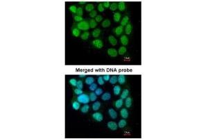 ICC/IF Image Immunofluorescence analysis of paraformaldehyde-fixed A431, using cyclin T2, antibody at 1:200 dilution. (Cyclin T2 anticorps  (C-Term))