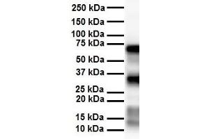 WB Suggested Anti-SLC25A12 antibody Titration: 1 ug/mL Sample Type: Human heart
