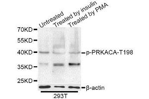 Western blot analysis of extracts of 293T cells,using Phospho-PRKACA-T197 antibody (ABIN5995920) at 1/1000 dilution. (PRKACA anticorps  (pThr198))