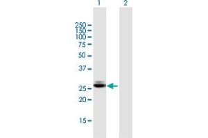 Western Blot analysis of CTRB1 expression in transfected 293T cell line by CTRB1 MaxPab polyclonal antibody. (CTRB1 anticorps  (AA 1-263))