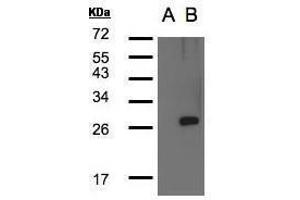 WB Image Western Blot analysis of LYPLA1 expression in transfected 293T cell line by LYPLA1polyclonal antibody. (LYPLA1 anticorps)