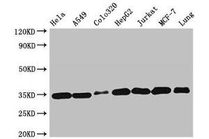 Western Blot Positive WB detected in: Hela whole cell lysate, A549 whole cell lysate, Colo320 whole cell lysate, HepG2 whole cell lysate, Jurkat whole cell lysate, MCF-7 whole cell lysate, Mouse lung tissue All lanes: EMD antibody at 2 μg/mL Secondary Goat polyclonal to rabbit IgG at 1/50000 dilution Predicted band size: 29 kDa Observed band size: 35 kDa