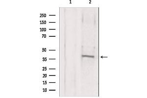 Western blot analysis of extracts from mouse brain, using MAT2B antibody. (MAT2B anticorps  (Internal Region))