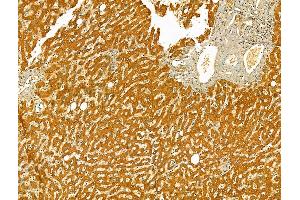 ABIN6265416 and ABIN6273079 at 1/100 staining Human normal tissues adjacent to liver cancer by IHC-P. (SYVN1 anticorps  (Internal Region))