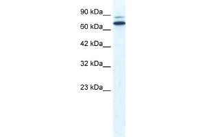 WB Suggested Anti-ZNF57 Antibody Titration:  0. (ZFP57 anticorps  (N-Term))