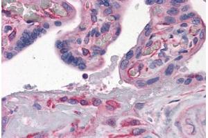 Human Placenta: Formalin-Fixed, Paraffin-Embedded (FFPE)