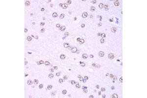 Immunohistochemistry of paraffin-embedded rat brain using Nono Antibody. (NONO anticorps  (AA 1-300))