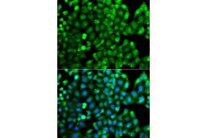 Immunofluorescence analysis of A549 cell using HLA-DRB1 antibody. (HLA-DRB1 anticorps)