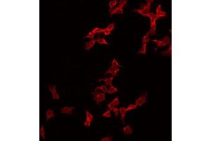ABIN6274995 staining Hela by IF/ICC. (CBLN2 anticorps  (N-Term))