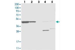 Western blot analysis of Lane 1: RT-4, Lane 2: U-251 MG, Lane 3: Human Plasma, Lane 4: Liver, Lane 5: Tonsil with OLA1 polyclonal antibody  at 1:250-1:500 dilution. (OLA1 anticorps)