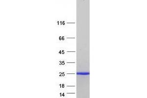 Validation with Western Blot