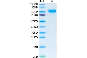 Human IL-1 Rrp2 on Tris-Bis PAGE under reduced condition.