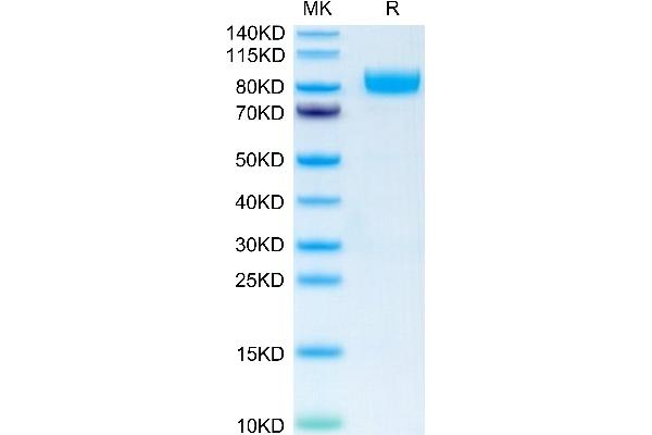 IL1RL2 Protein (AA 20-335) (Fc Tag)