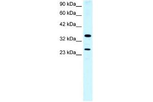 ASGR2 antibody used at 0. (Asialoglycoprotein Receptor 2 anticorps  (N-Term))