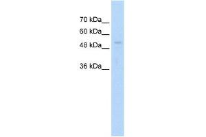 WB Suggested Anti-ARIH1 Antibody Titration:  1. (ARIH1 anticorps  (C-Term))