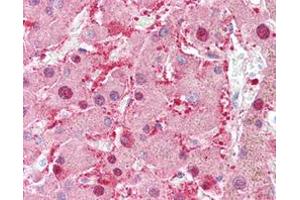 Immunohistochemical staining (Formalin-fixed paraffin-embedded sections) of human liver with AKR1C1 monoclonal antibody, clone AT6D10 . (AKR1C1 anticorps)