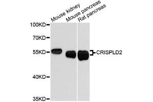 Western blot analysis of extracts of various cell lines, using CRISPLD2 antibody.