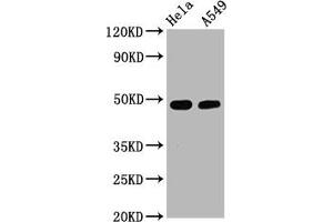 Western Blot Positive WB detected in Hela whole cell lysate,A549 whole cell lysate All lanes Phospho-GATA3 antibody at 2. (Recombinant GATA3 anticorps  (pSer308))