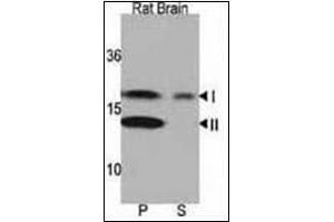 Western blot analysis of LC3 Antibody in Rat brain lysate. (MAP1LC3A anticorps  (N-Term))