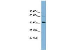 Image no. 1 for anti-UEV and Lactate/malate Dehyrogenase Domains (UEVLD) (AA 143-192) antibody (ABIN6742158) (UEVLD anticorps  (AA 143-192))