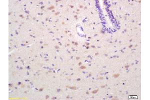 Formalin-fixed and paraffin embedded rat brain labeled with Rabbit Anti EPH receptor A4 Polyclonal Antibody, Unconjugated (ABIN734123) at 1:200 followed by conjugation to the secondary antibody and DAB staining (EPH Receptor A4 anticorps  (AA 531-630))