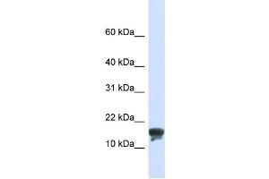 WB Suggested Anti-TMEM166 Antibody Titration:  0. (TMEM166 anticorps  (N-Term))