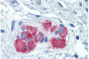 Human Colon, submucosal plexus: Formalin-Fixed, Paraffin-Embedded (FFPE) (FARSB anticorps  (AA 234-342))
