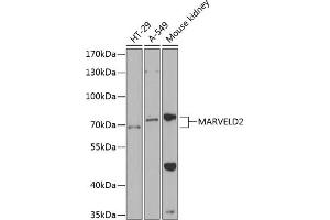 Western blot analysis of extracts of various cell lines, using M antibody  at 1:1000 dilution. (Tricellulin anticorps  (AA 1-195))