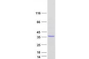Validation with Western Blot
