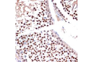 Immunohistochemistry of paraffin-embedded rat testis using NUP153 Rabbit mAb (ABIN1512527, ABIN3023298, ABIN3023299 and ABIN7101477) at dilution of 1:100 (40x lens). (NUP153 anticorps)