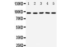 Anti-TrkC antibody,  Western blotting Lane 1: Rat Brain Tissue Lysate Lane 2: Mouse Brain Tissue Lysate Lane 3: U87 Cell Lysate Lane 4: SHG Cell Lysate Lane 5: NEURO Cell Lysate